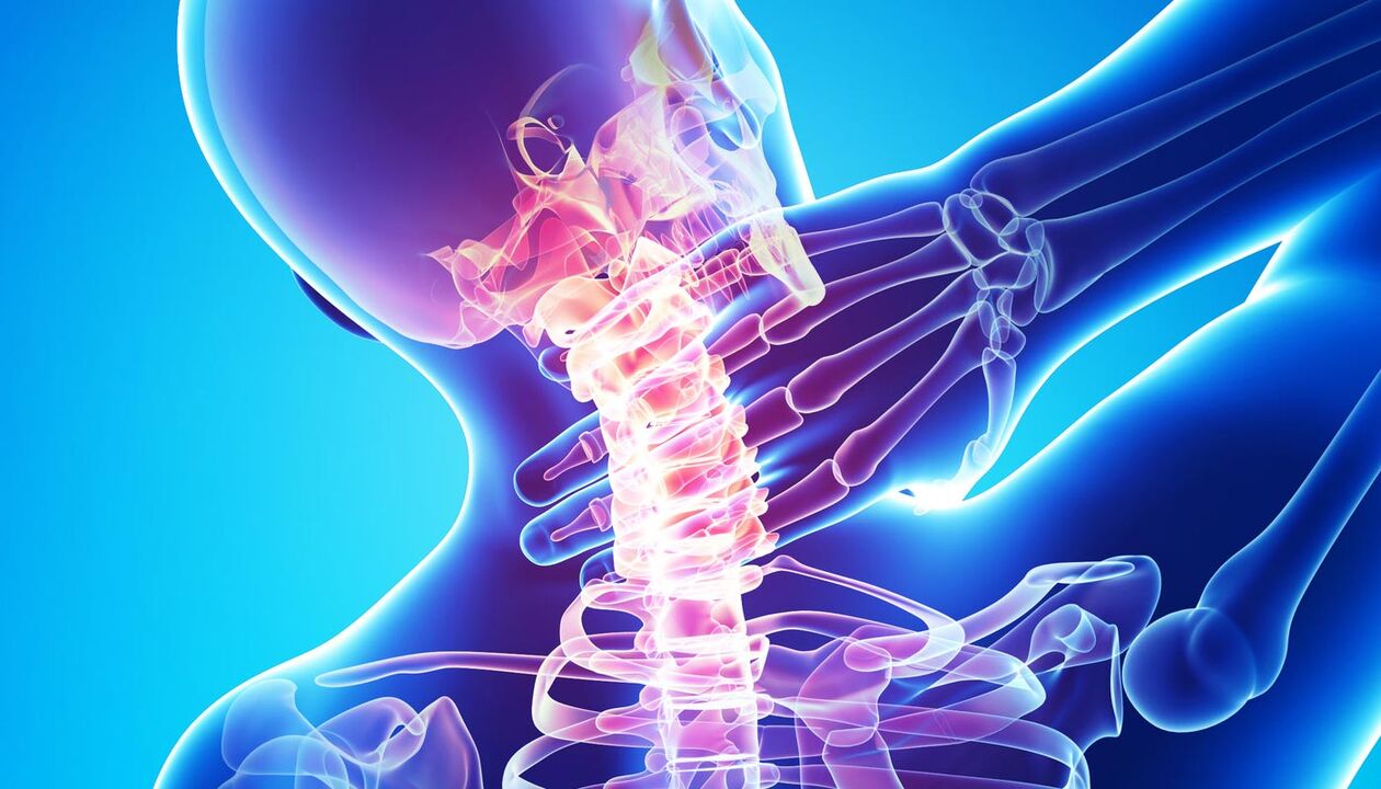 Dolore al collo dovuto all'osteocondrosi